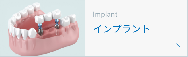 インプラントボタン